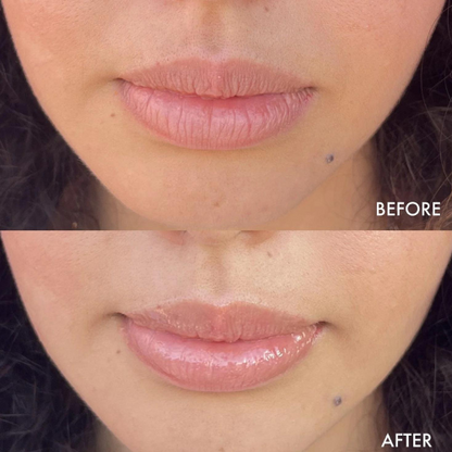 Lip Luxe Plumper