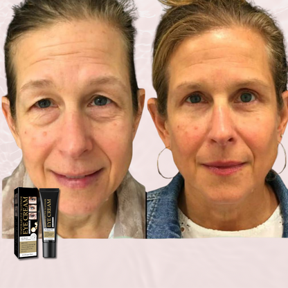 Face Tightening + Eyebag Removal Cream ✨