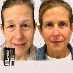 Face Tightening + Eyebag Removal Cream ✨