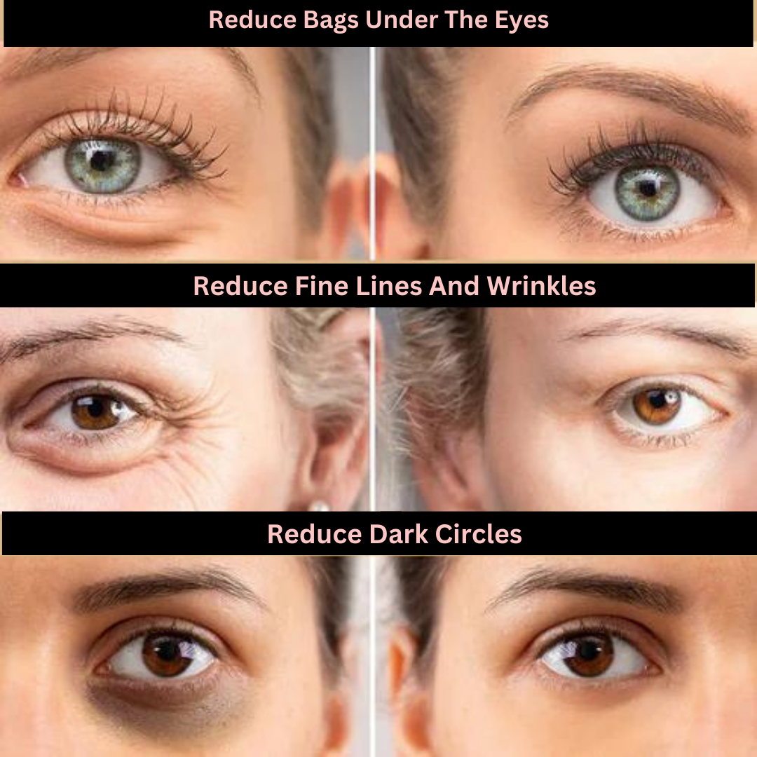 Face Tightening + Eyebag Removal Cream ✨