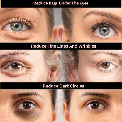 Face Tightening + Eyebag Removal Cream ✨