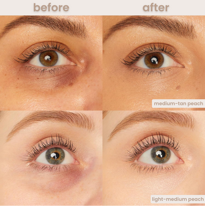 LumiCover™ - Under Eye Colour Corrector