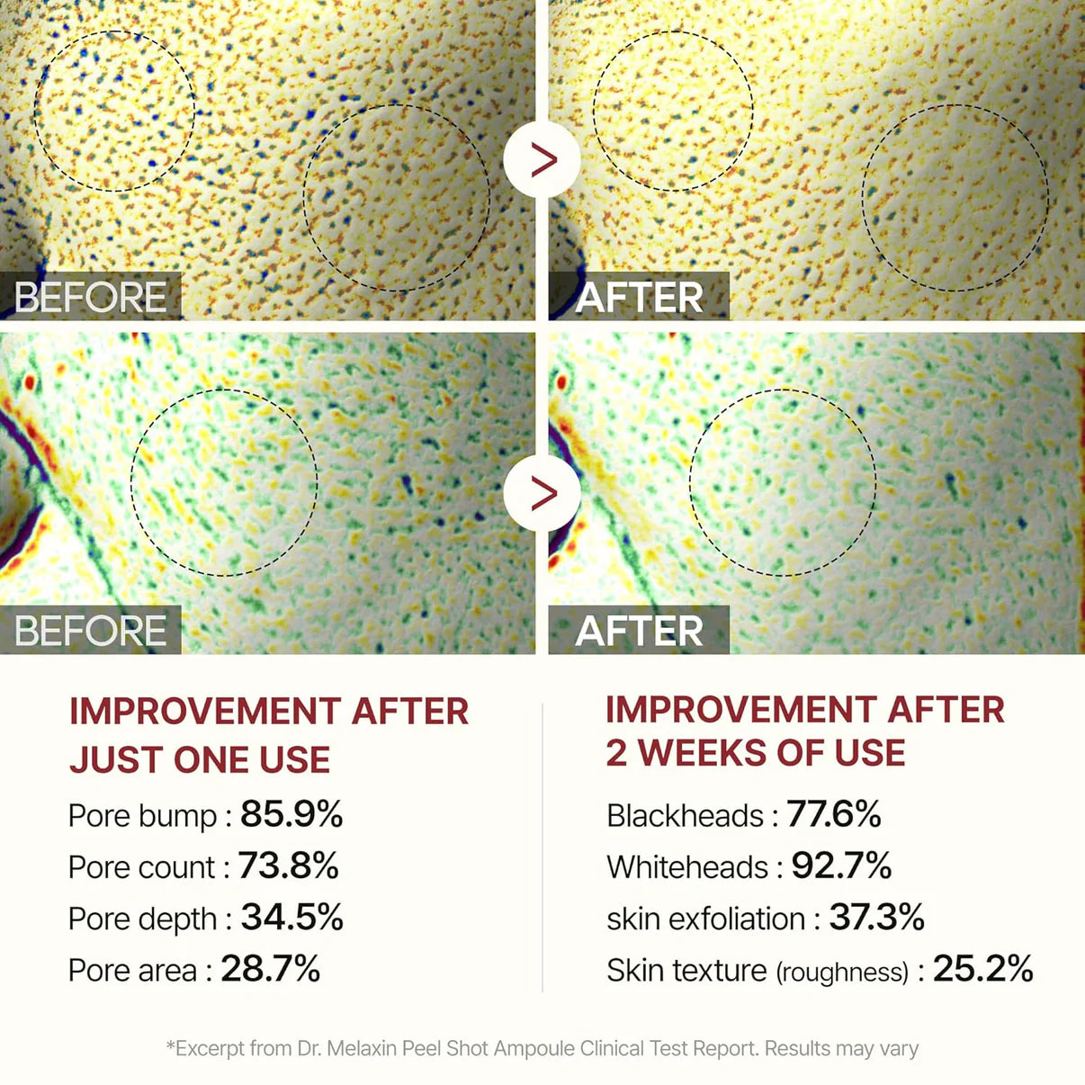 Radiant Rice Peel™ – ShimmeryGlo