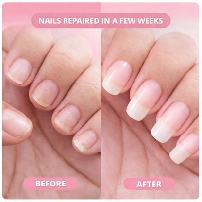 ShimmeryGlo™ NailRevive Growth Serum