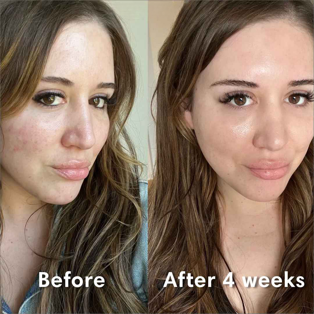 Bio-Collagen Glass Face Mask
